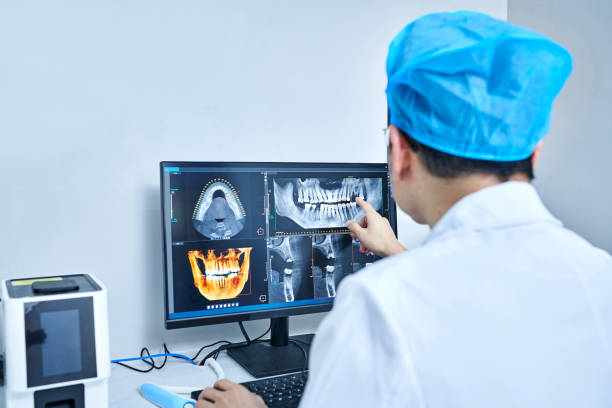 Best Knocked-Out Tooth (Avulsed Tooth) Treatment in Elk Grove, CA